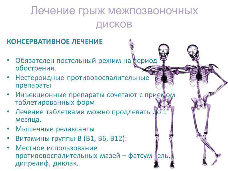 Методы лечения межпозвоночных грыж