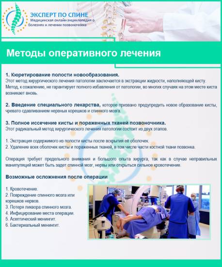Методы оперативного лечения