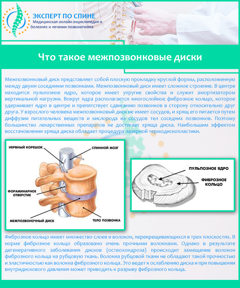 Межпозвоночные диски - что они собой представляют