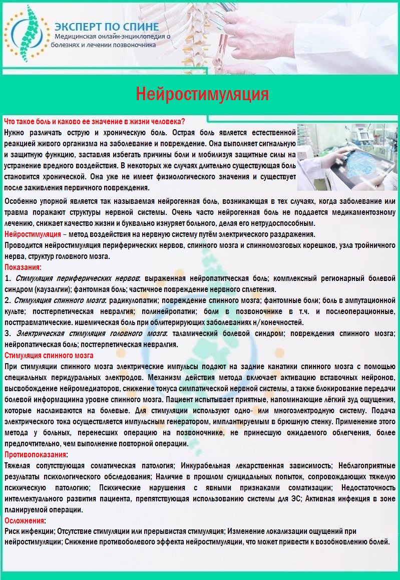 Нейростимуляция