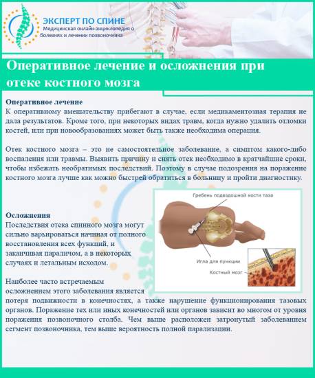 Оперативное лечение и осложнения при отеке костного мозга