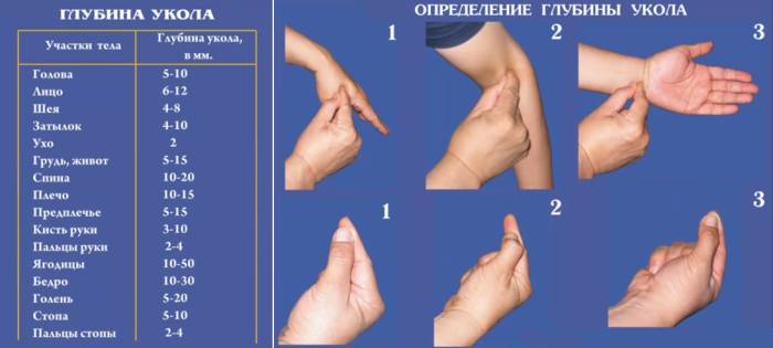 Определение глубины укола