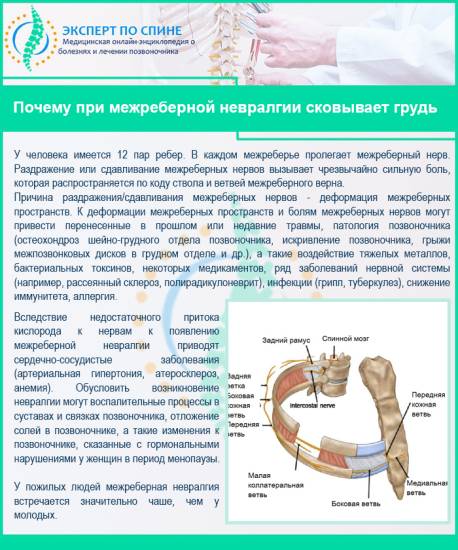 Почему при межреберной невралгии сковывает грудь