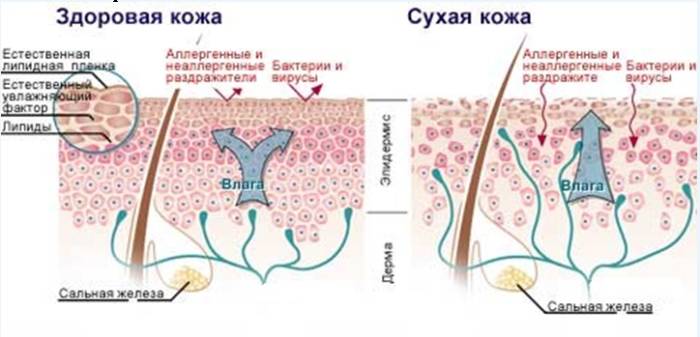 Потеря влаги кожей