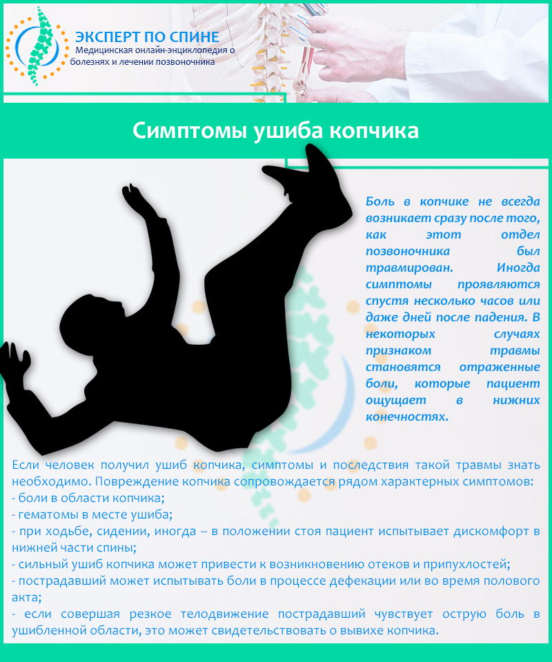 Симптомы ушиба копчика