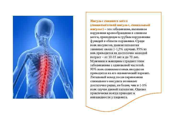Спинальный инсульт