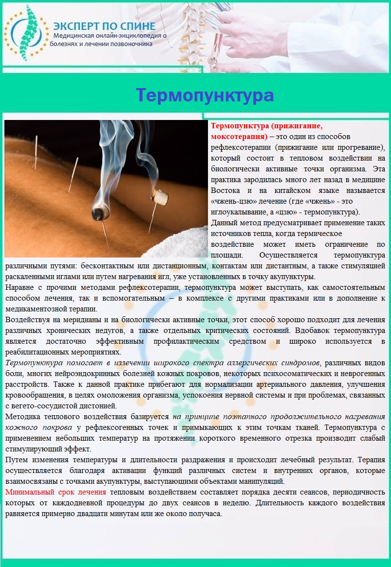 Термопунктура