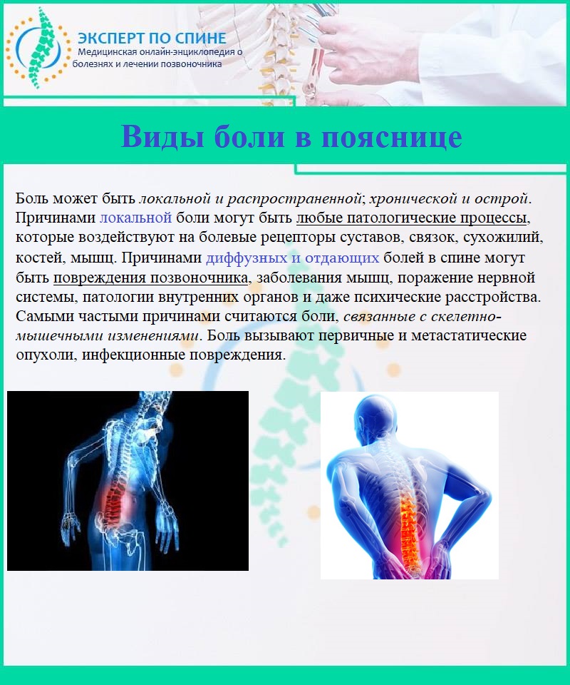 Виды боли