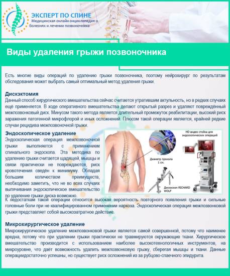 Виды удаления грыжи позвоночника