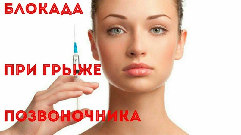 Блокада бывает нескольких типов