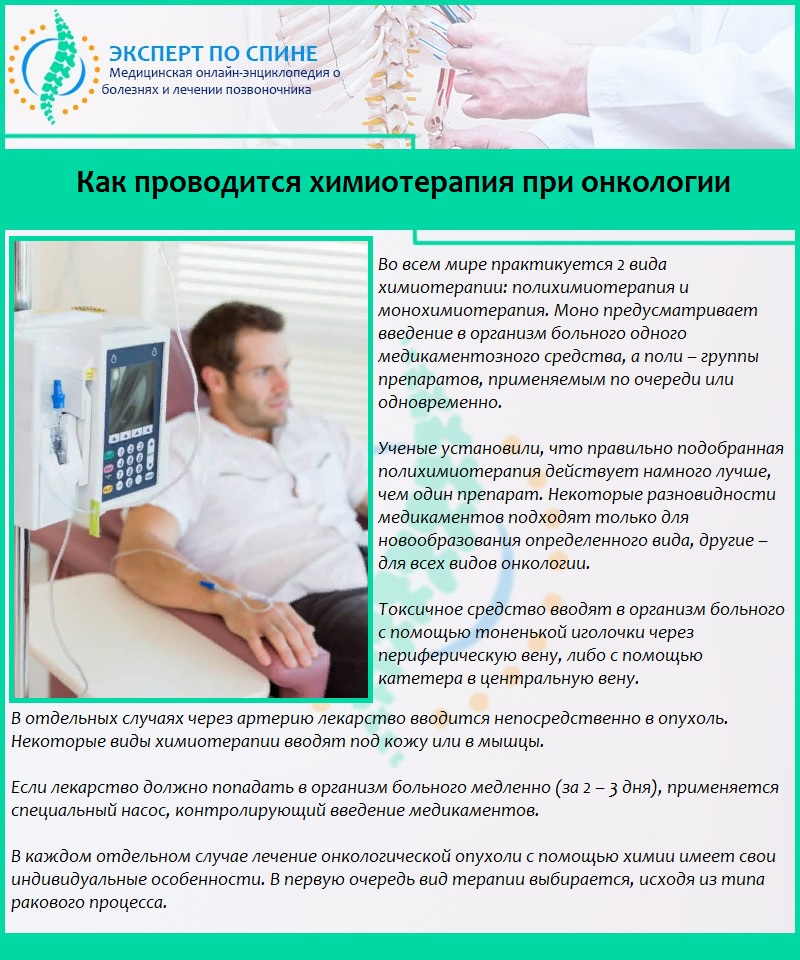 Как проводится химиотерапия при онкологии
