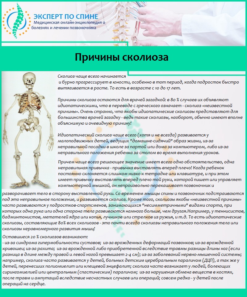 Причины сколиоза
