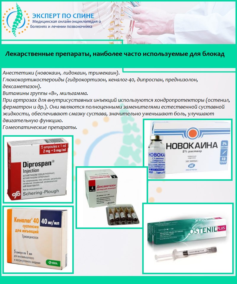 Лекарственные препараты, наиболее часто используемые для блокад