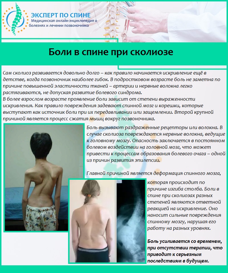 Боли в спине при сколиозе