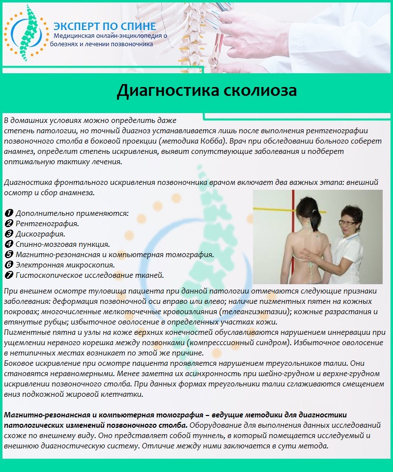 Диагностика сколиоза