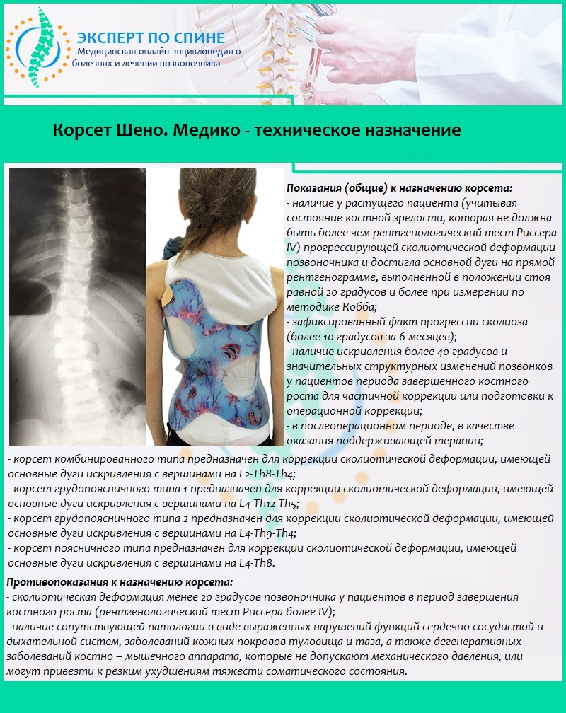 Корсет Шено. Медико - техническое назначение