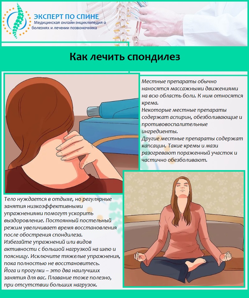 Как лечить спондилез