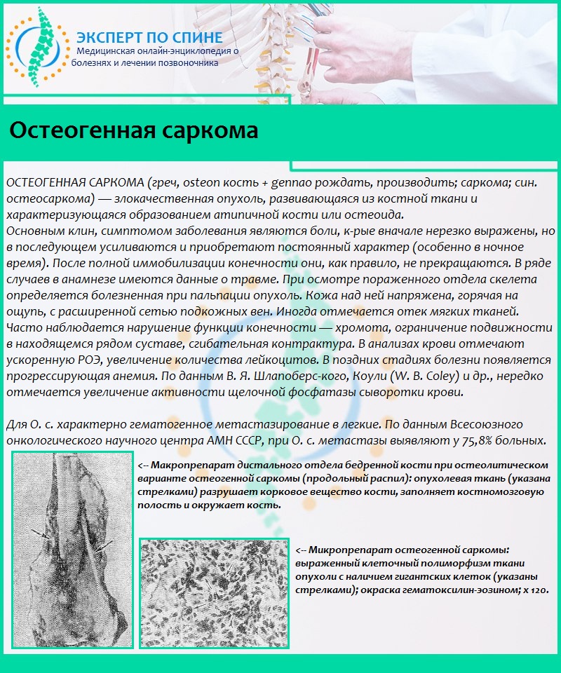 Остеогенная саркома