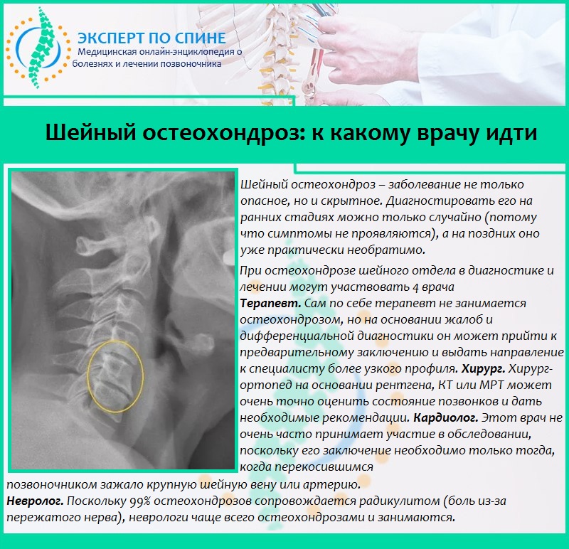 Шейный остеохондроз: к какому врачу идти