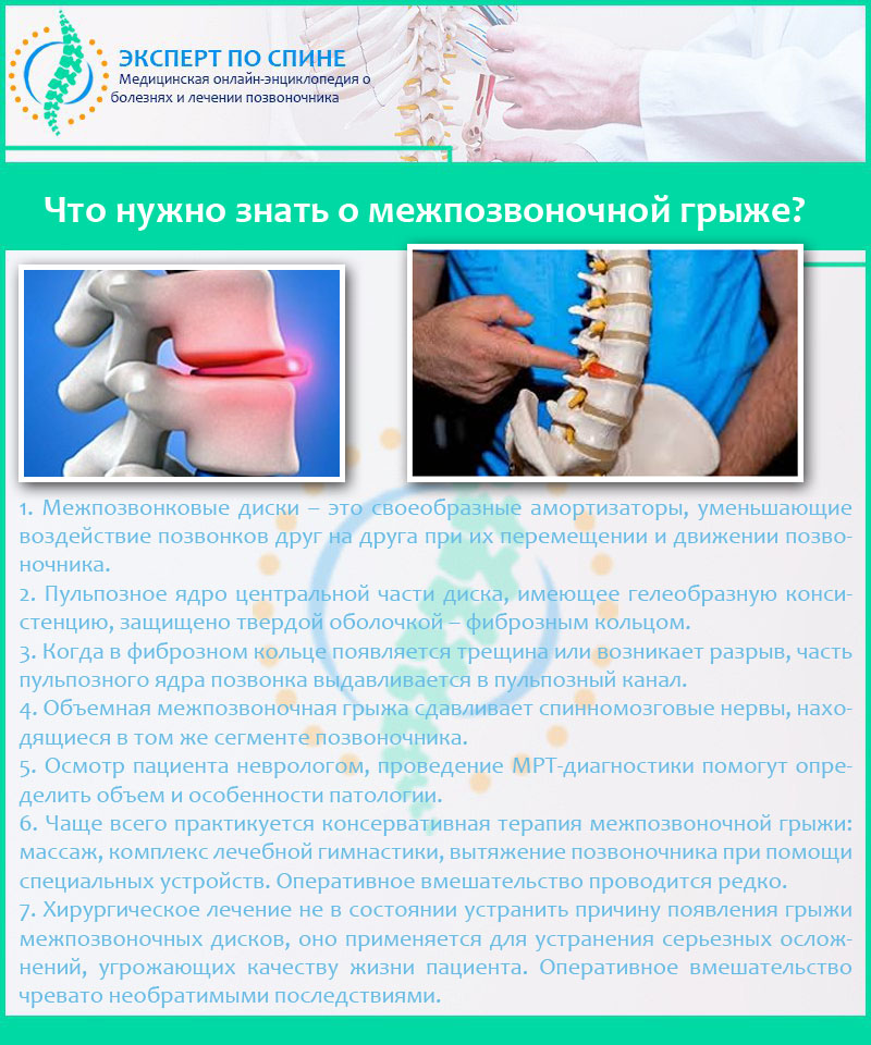 Что нужно знать о межпозвоночной грыже