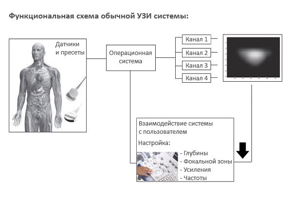 Функциональная схема традиционной системы УЗИ