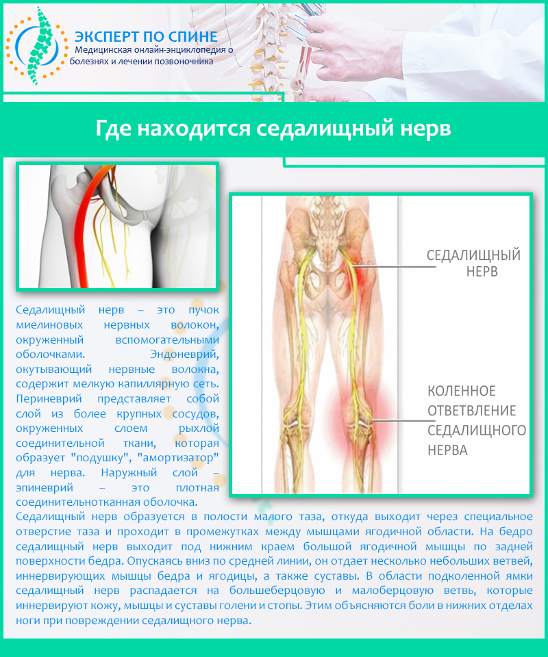 Где находится седалищный нерв