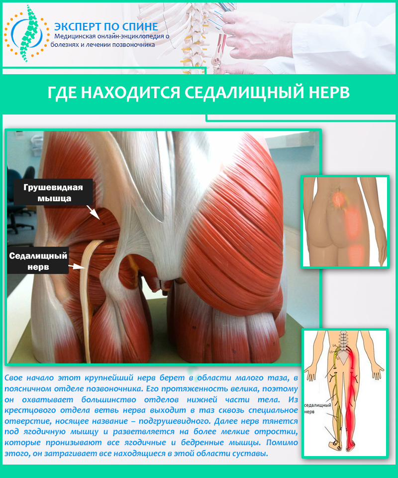 Где находится седалищный нерв