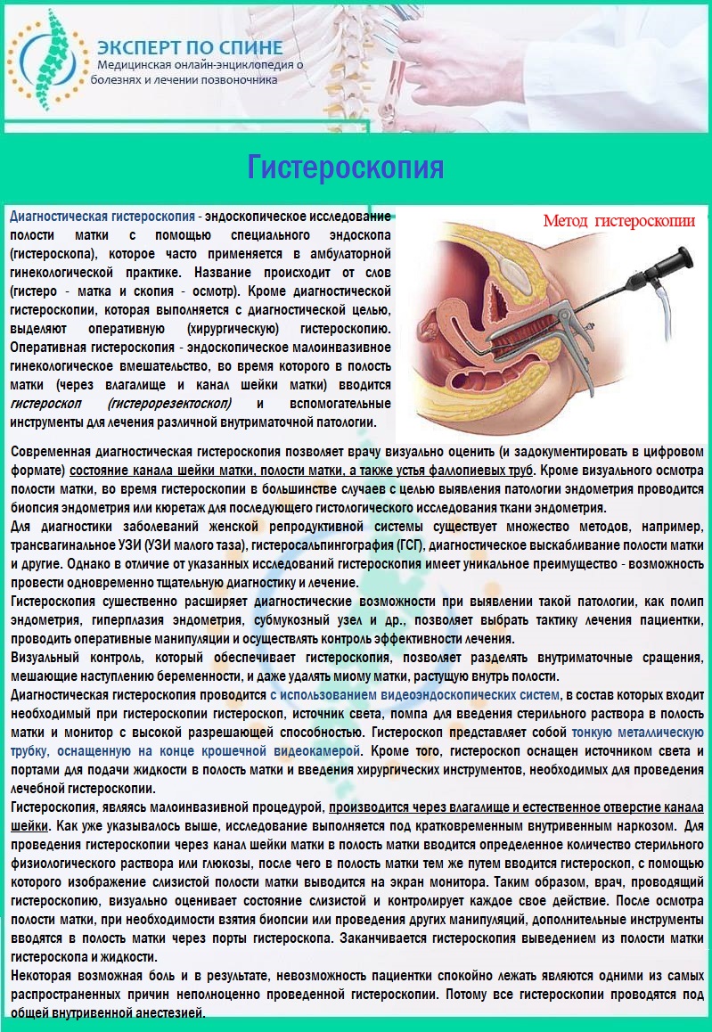 Гистероскопия