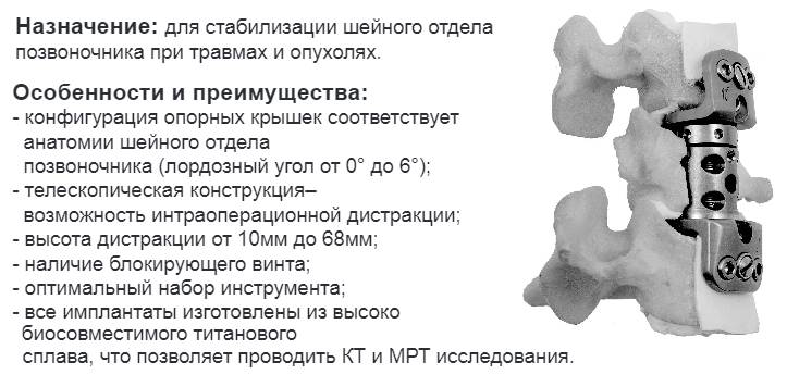 Кейдж дистракционный для шейного отдела