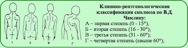Классификация по Чаклину