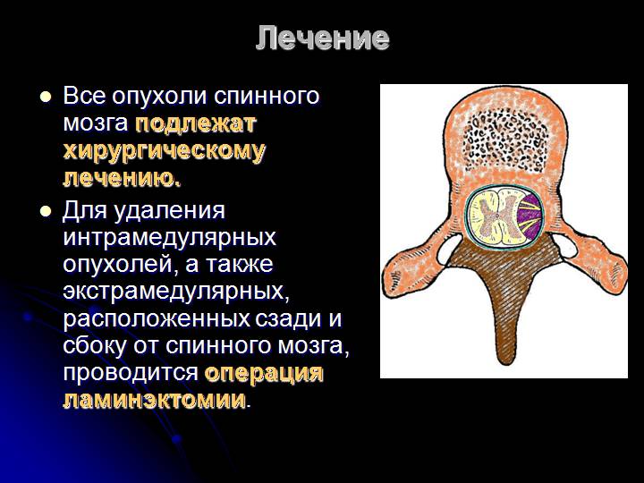 Лечение