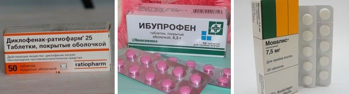 Лекарства, снимающие боль при воспалении седалищного нерва