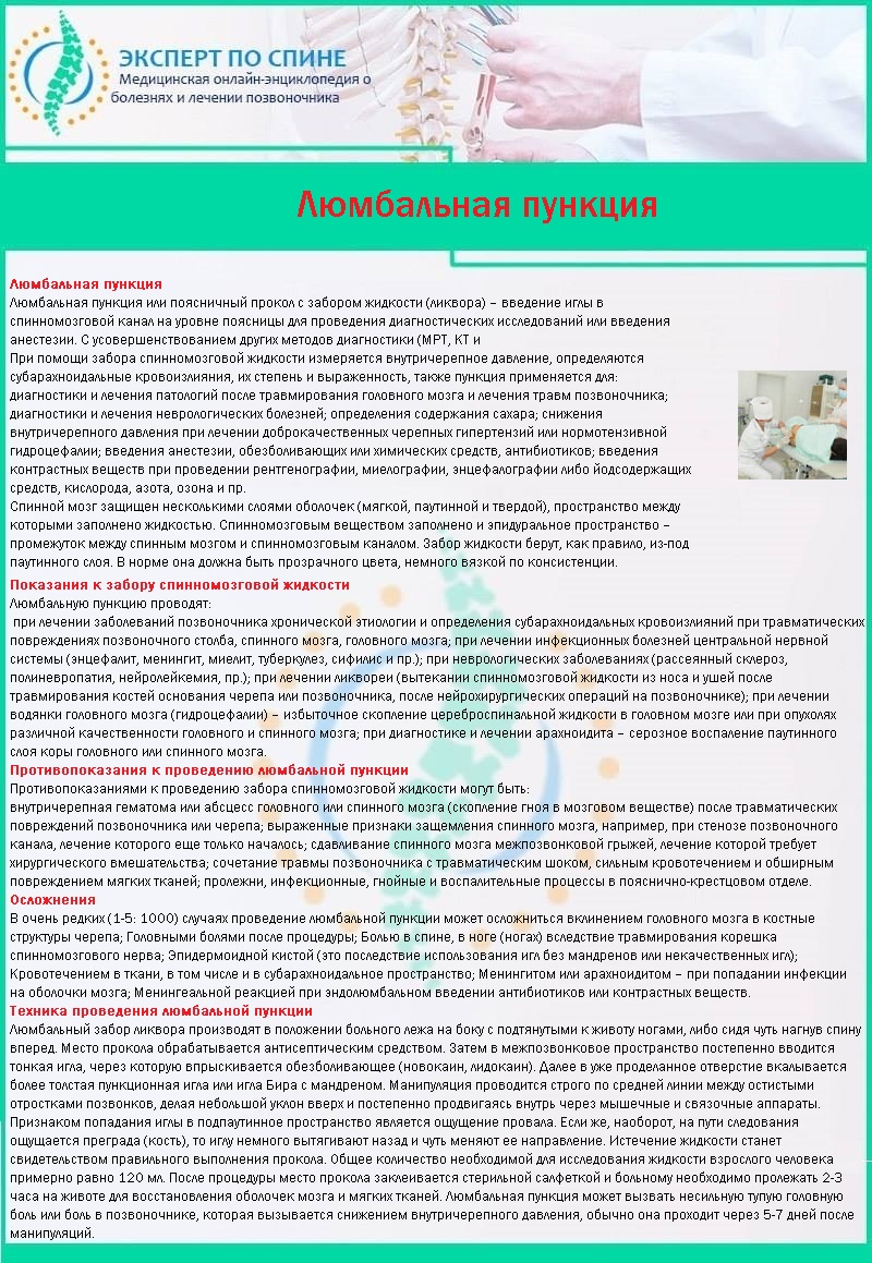 Люмбальная пункция