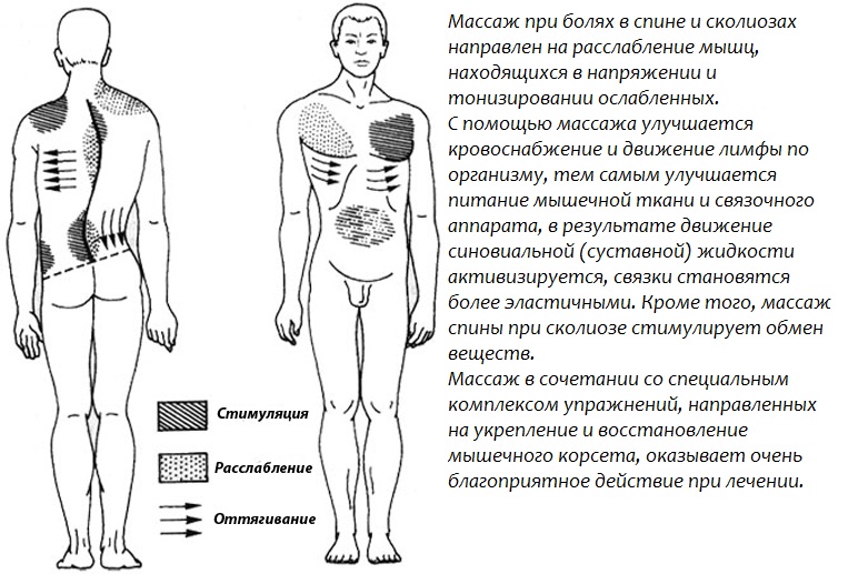 Действие массажа при сколиозе