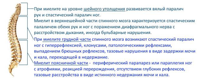 Миелит разных участков спинного мозга