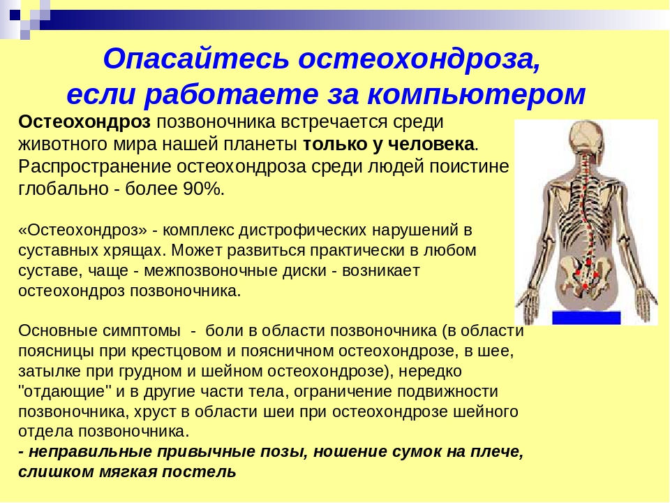 Опасайтесь остеохондроза, если работаете за компьютером