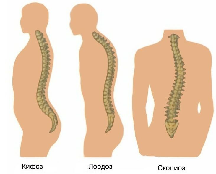 Патологические изгибы