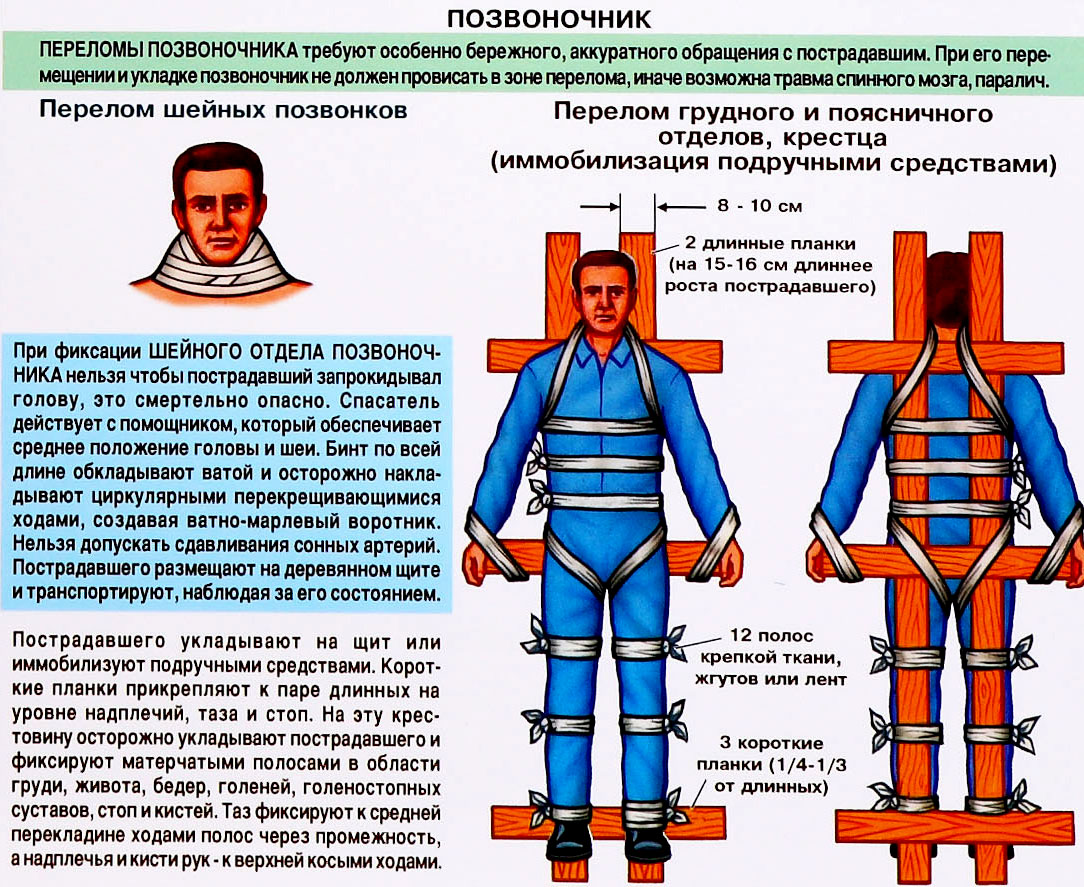 Первая помощь при переломе позвоночника