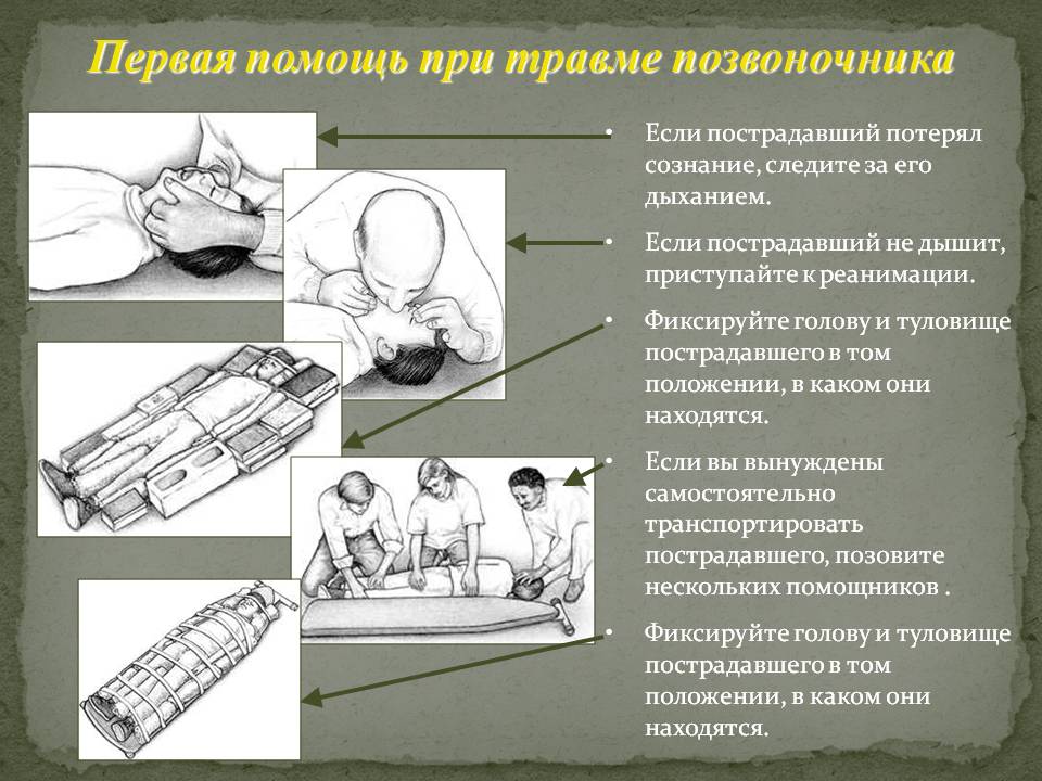 Первая помощь при травме позвоночника