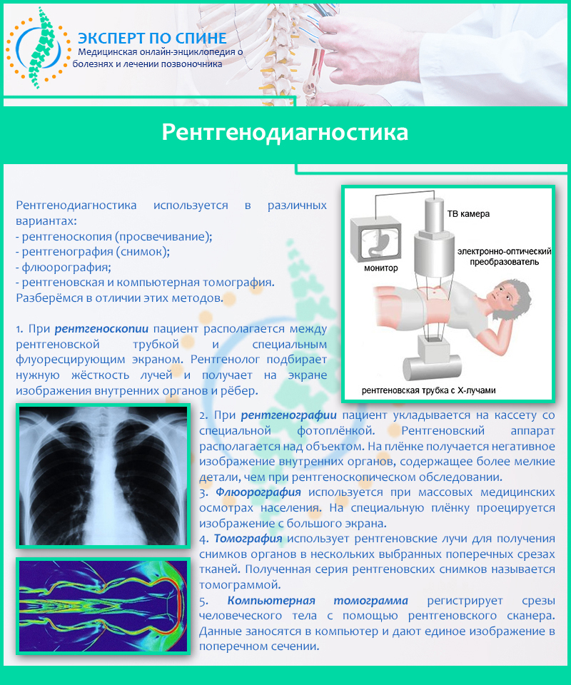 Рентгенодиагностика