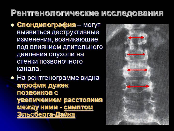 Рентгенологические исследования