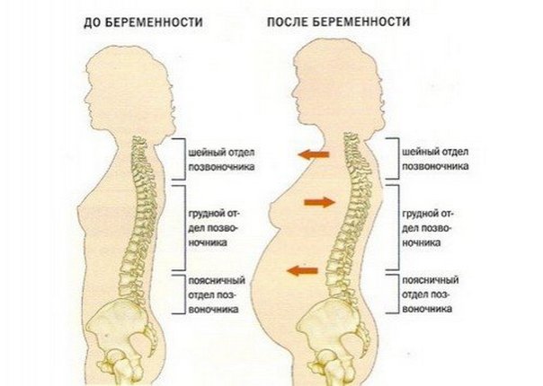 Схема строения позвоночника у женщин до беременности и во время