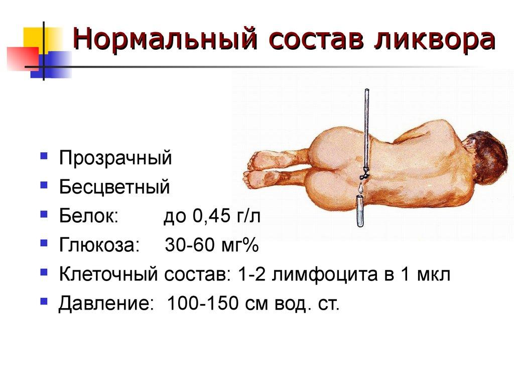 Состав ликвора