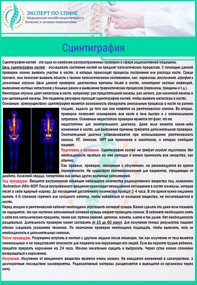 Сцинтиграфия