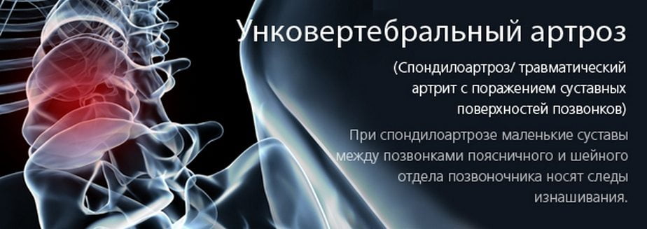 Ункоартроз