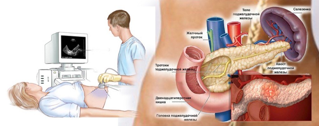 УЗИ органов брюшной полости