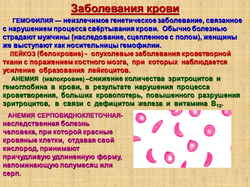 Заболевания крови