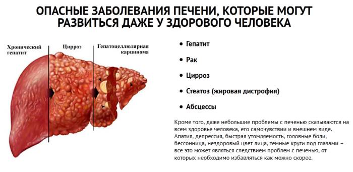 Заболевания печени