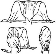 Косыночная повязка на кисть