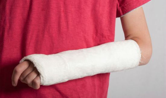 левая-рука-в-гипсе